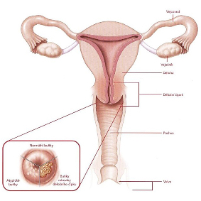 FDA Approves First Targeted Therapeutic for BRCA-mutant Breast Cancer