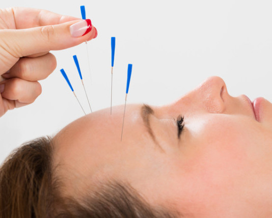 Akupunktura může snížit bolest kloubů související s léčbou pacientek s rakovinou prsu